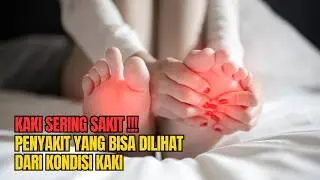 Tanda-Tanda Kesehatan dari Telapak Kaki: Fakta Menarik yang Harus Anda Ketahui