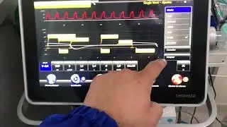 Curvas de presión, volumen, flujo y bucles