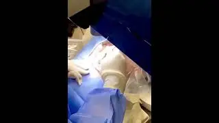 Eksimer Lazer emeliyyati - Cerrah oftalmoloq Sidiqe Eliyeva
