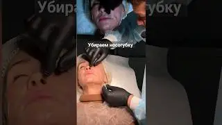 Как убрать носогубную складку?