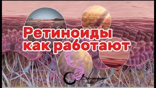 РЕТИНОИДЫ как это работает.