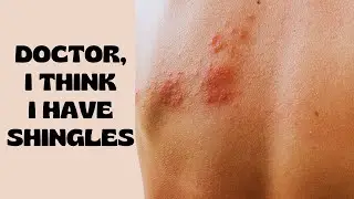 How To Spot A Shingles Rash | Herpes Zoster Virus Symptoms