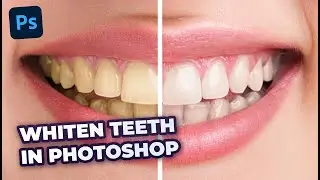 The BEST Way to Whiten Teeth in Photoshop