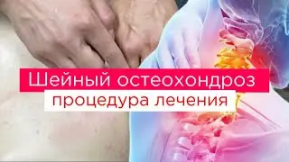 Как вылечить:Головные боли.Головокружения. Онемение рук.Миопрессура шейной мускулатуры.