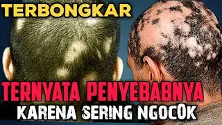 RAMBUT RONTOK TIBA TIBA PENYAKIT APA INI??