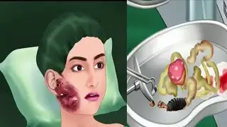 INSECT BITES: The Horrible Reality Behind Them