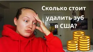 Сэкономила в РФ , переплатила в США. Мой опыт удаления зубов мудрости в США.