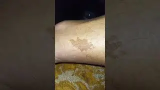 ну очень необычная родинка. чтобы это значило????