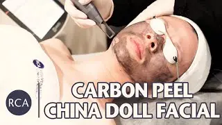 China Doll Face treatment - Best Carbon Laser Peel Facial treatment for Porcelain Skin