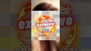 Вика Боня сняла очки и показала лицо после пластики 
