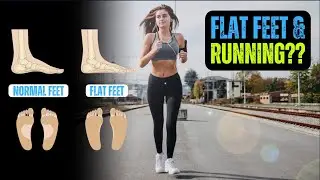 Flat Feet & Running Shoes: What You NEED to Know | Dr. Kunal Answers