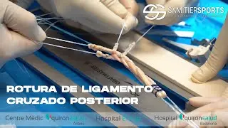 ROTURA DEL LIGAMENTO CRUZADO POSTERIOR