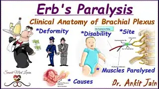 Erb's paralysis/Brachial Plexus Injury/Erb's Palsy/Simplified Anatomy- Deformity Disability/in hindi