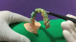 Treatment Of Blackhead Removal at Lam Dep Spa #037