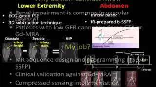 Peripheral Magnetic Resonance Angiography without Contrast - Iliyana Plamenova Atanasova