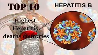 Top 10-Highest Hepatitis deaths countries (1990-2017)
