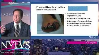 Why the High Failure Rate in TMA’s  The Angiosome Concept   Robert J  Snyder