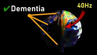 IT'S HERE ❯❯❯ The Dementia 