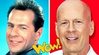 Famous Actors Before And After Going Bald