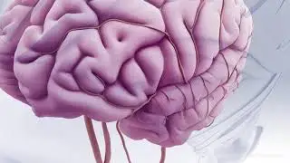 Ischemic Stroke With tPA Animation
