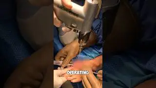 How to insert a screw into a foot! 😳 