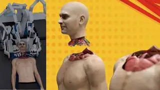 Vidéo CHOC : des robots greffeur de tête ! bientôt possible