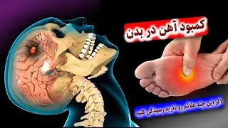 هنگامی که بدن با کمبود آهن مواجه میشود چه علائمی دارد