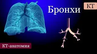 КТ лёгких: как понять бронхиальное дерево и не запутаться. Анатомия ПРОСТЫМИ СЛОВАМИ.