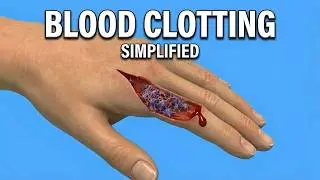 How Blood Clotting Works – Platelets, Clotting Factors & Fibrin Explained 🔬