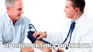 Профилактика инсульта