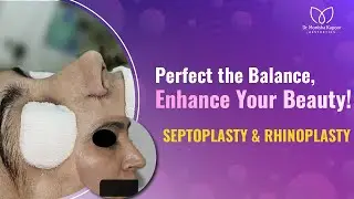 Desire Nose Like Celebrity Aditi Rao | Wide Nose Rhinoplasty | Nose Surgery Before and After Result
