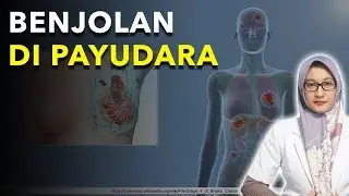 UNDERSTANDING BREAST LUMPS | ARE BREAST LUMPS PAINFUL | BREAST TUMOR & BREAST CANCER