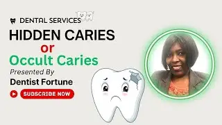 What is Hidden Caries 2025? | Causes, Symptoms, Prevention Tips