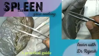 SPLEEN - Specimen demo