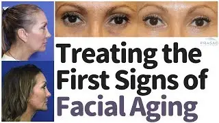 How the First Signs of Facial Aging, Especially Volume Loss, can be Treated without Surgery