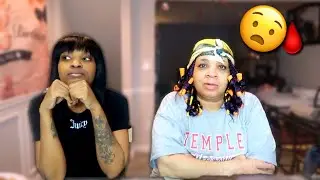 HOW DID MY MOM FOUND OUT I HAD SICKLE CELL ANEMIA * I WAS SUPPOSE TO HAVE DOWN SYNDROME*