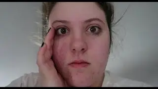 Vlog 51: Alarma de emergencia en el hotel