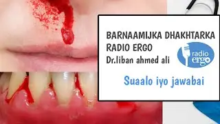 Qeybta 2aad Barnaamijka Dhakhtarka Ee Radio Ergo ayaan marti ku nahay su'aalo iyo jawaabo.