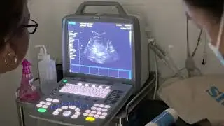 Gypsy ultrasound Feb 20, 2024
