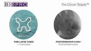 Clover Staple Movement