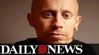 Verne Troyer, Mini Me in ‘Austin Powers,’ dead at 49
