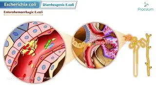 Escherichia coli (E. coli) Animation | Microbiology USMLE Step 1