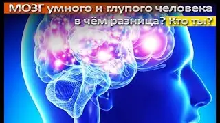 Мозг умных и глупых людей - в чём разница?