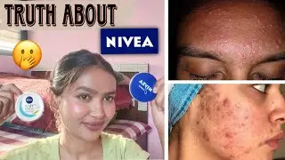 Truth about nivea 😦 | Which one is good ? | Nivea creme Vs Nivea soft | #nivea #review