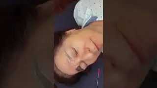 Nanoblading em pele madura