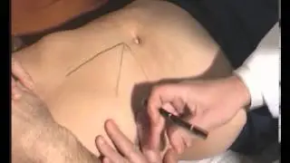 Живіт. Пальпація, перкусія. Яворський О.Г.