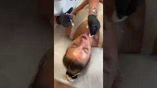 Сколько нужно пройти процедур для идеальной коррекция объема губ?💋