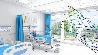 STENT