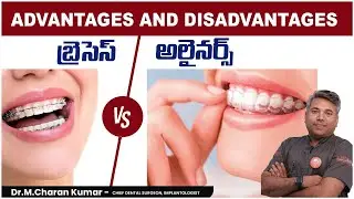 Invisible Braces Advantages And DisAdvantages | Braces VS Aligners || Eledent Dental Hospitals