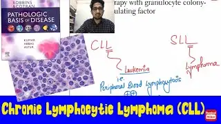 Chronic Lymphocytic Leukemia(CLL) /Small Lymphocytic Lymphoma (SLL) #inicet #neet_pg_2022  #robbins